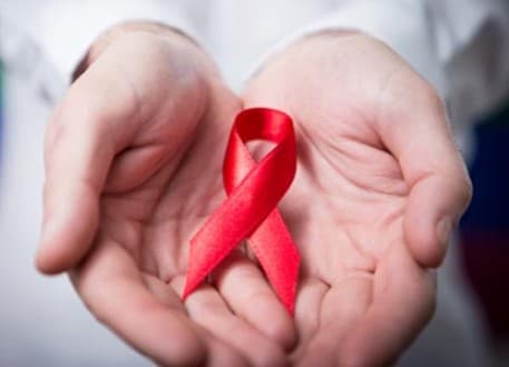 الإيدز